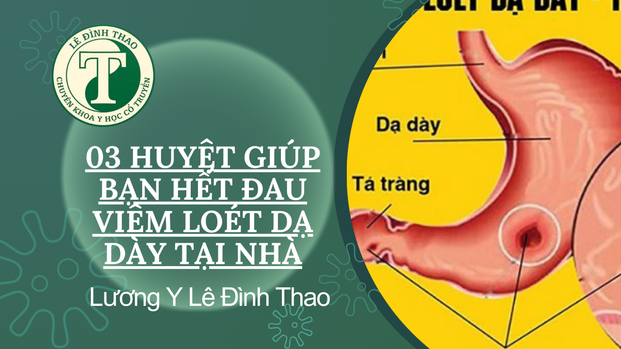 03 Huyệt giúp bạn hết đau Viêm loét dạ dày TẠI NHÀ l Lương Y Lê Đình Thao